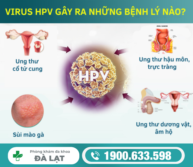 Hình ảnh minh họa